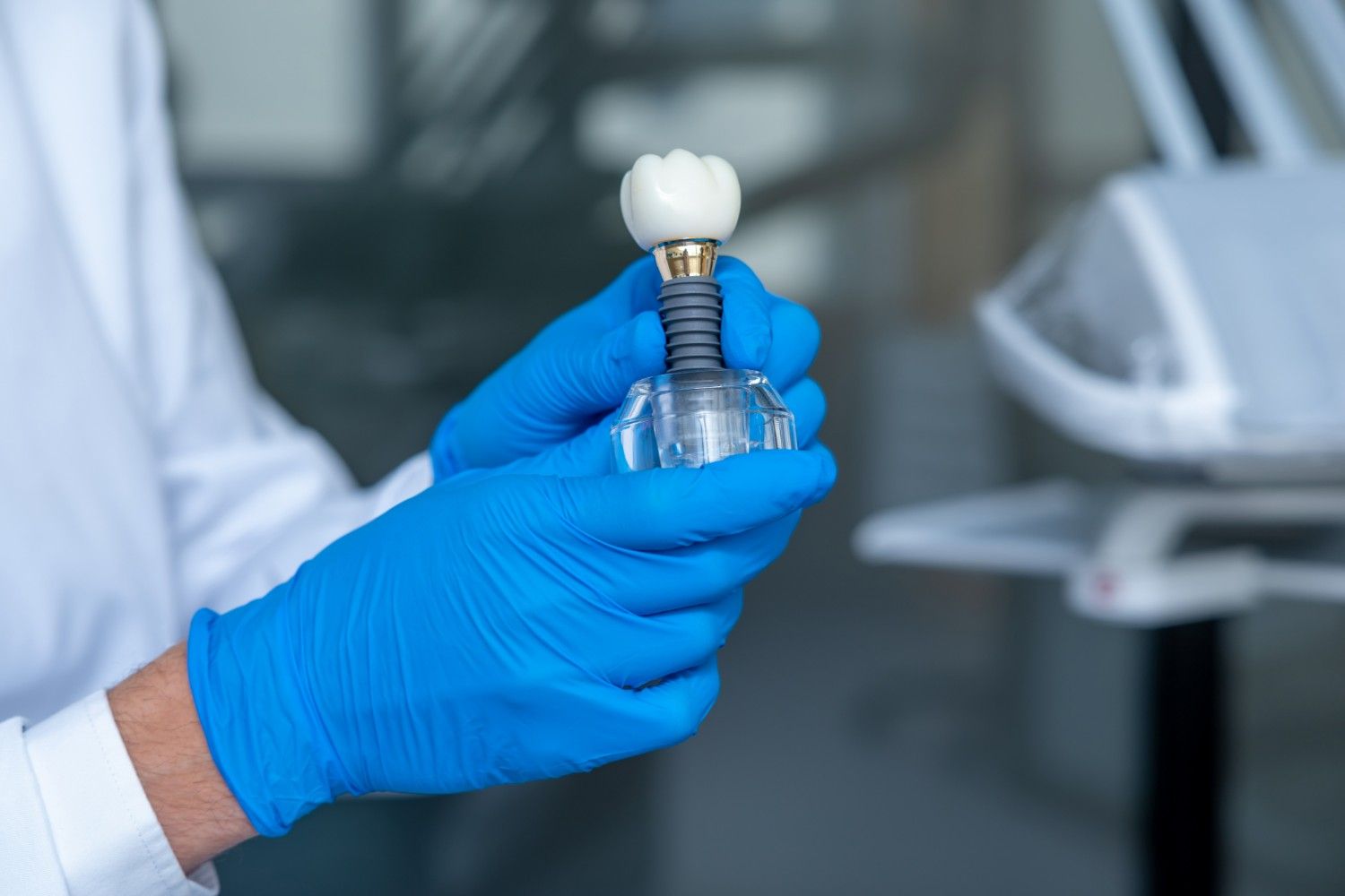 Everything You Need to Know About Dental Implants in Sharjah